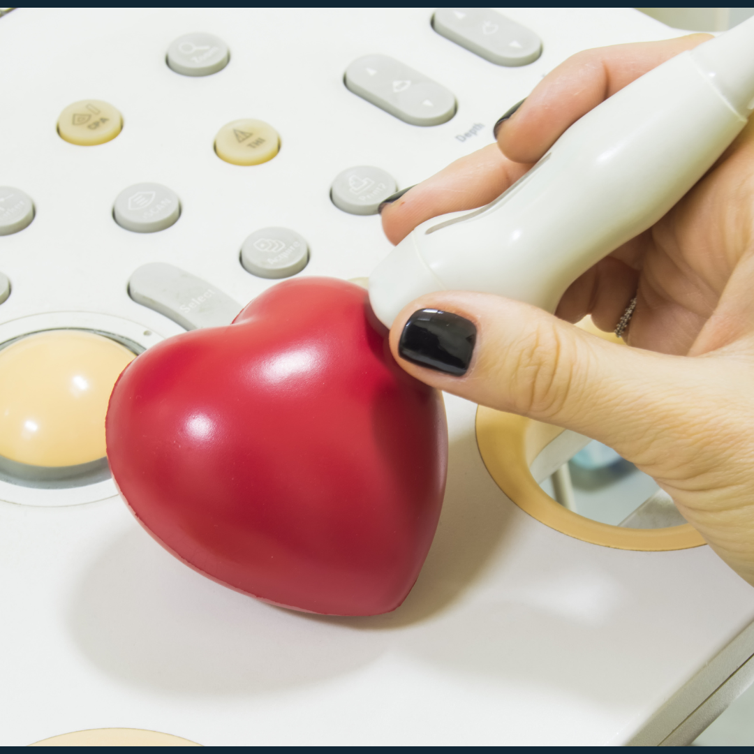 Imagen de Ecocardiografía